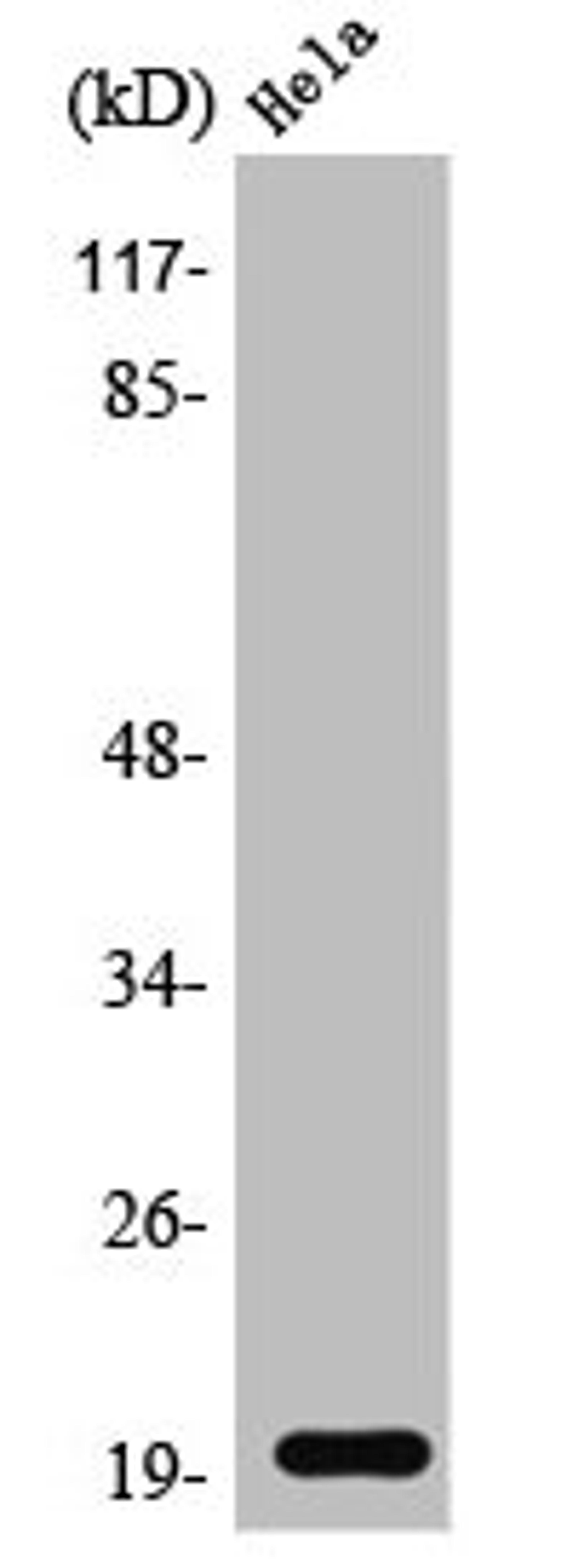Western Blot analysis of Jurkat cells using SRp20 Polyclonal Antibody