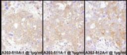 Detection of human STAT2 by immunohistochemistry.