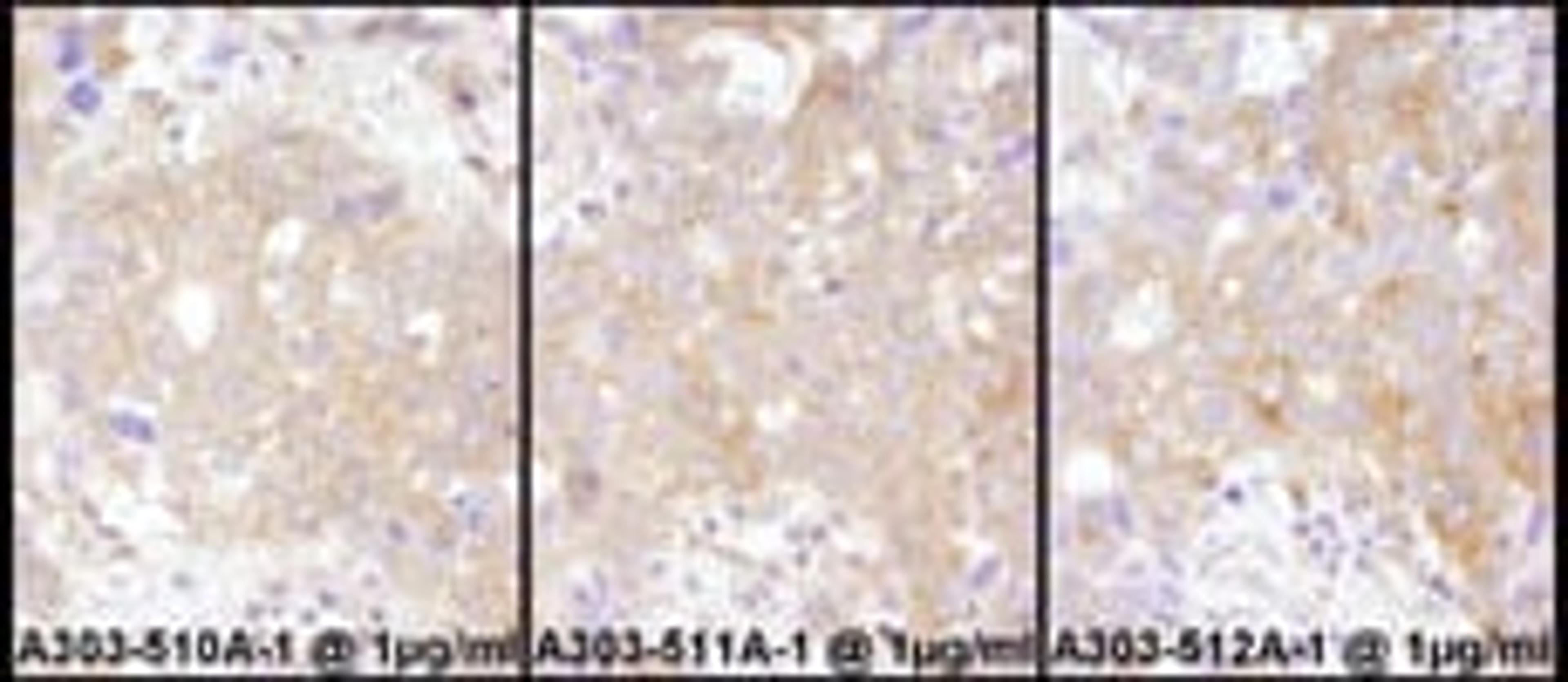 Detection of human STAT2 by immunohistochemistry.