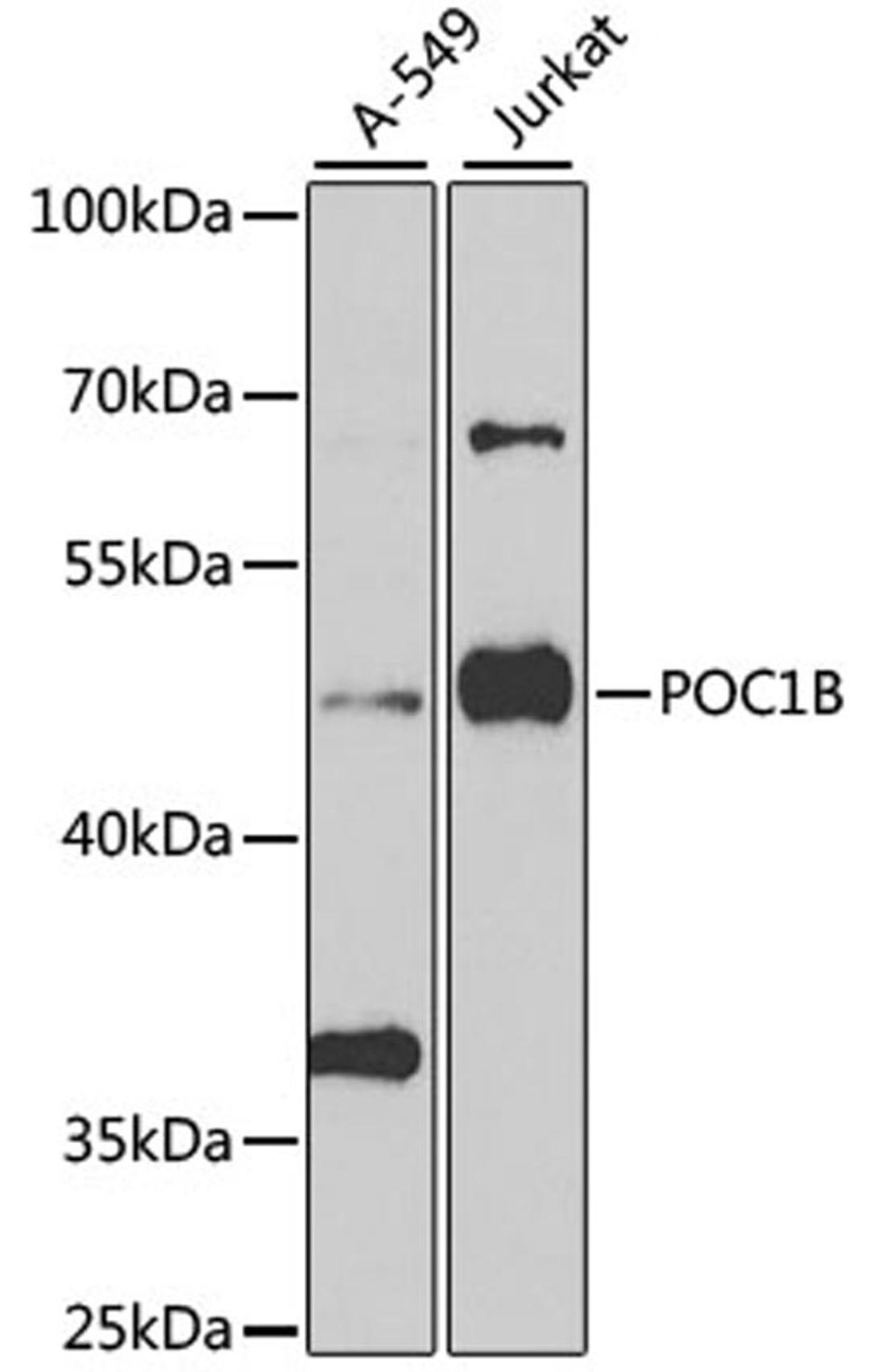 Western blot - POC1B antibody (A7616)