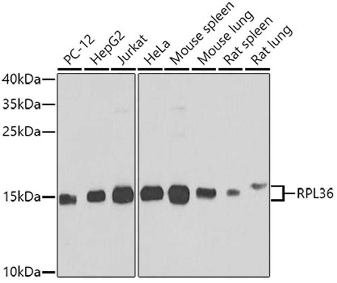 Western blot - RPL36 antibody (A7793)