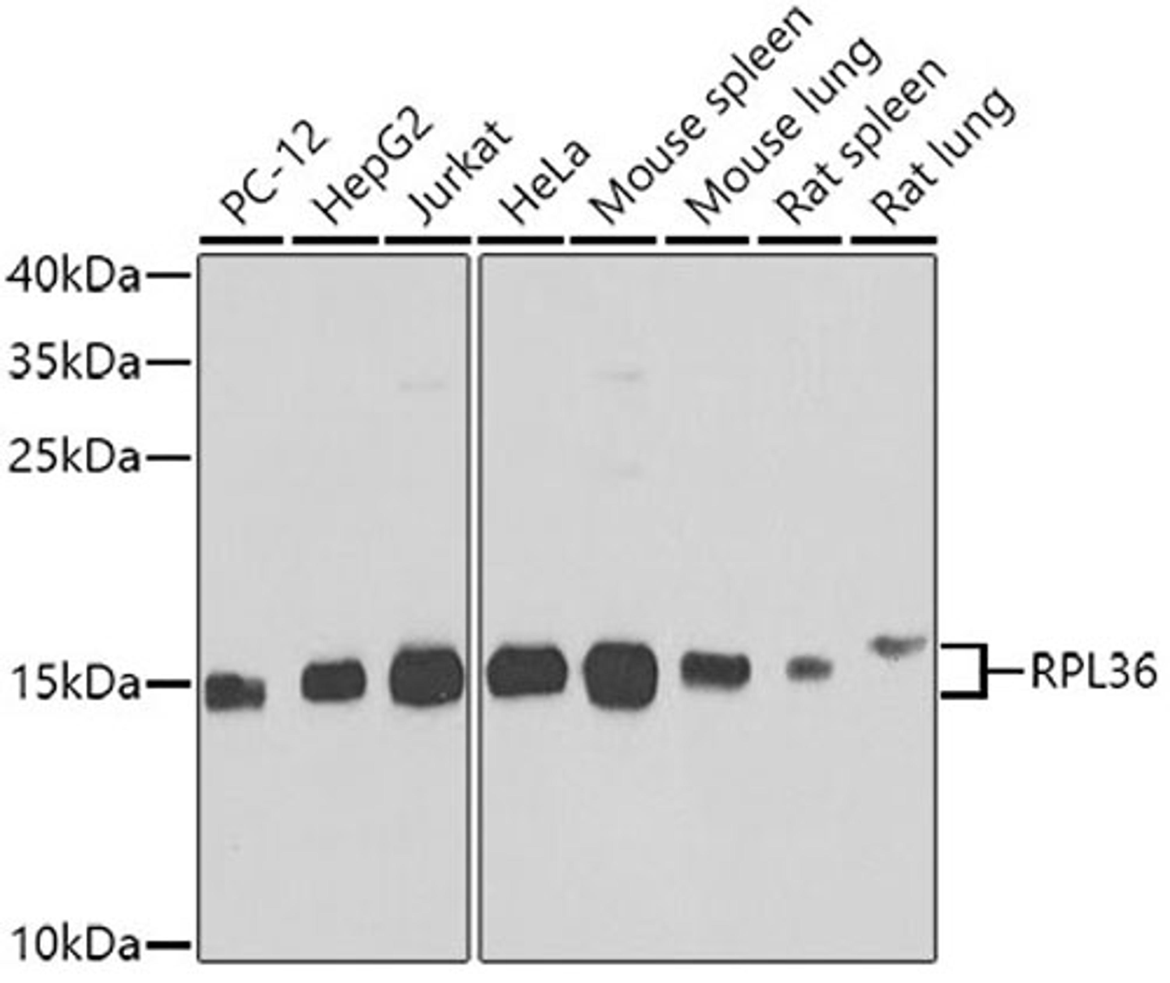 Western blot - RPL36 antibody (A7793)