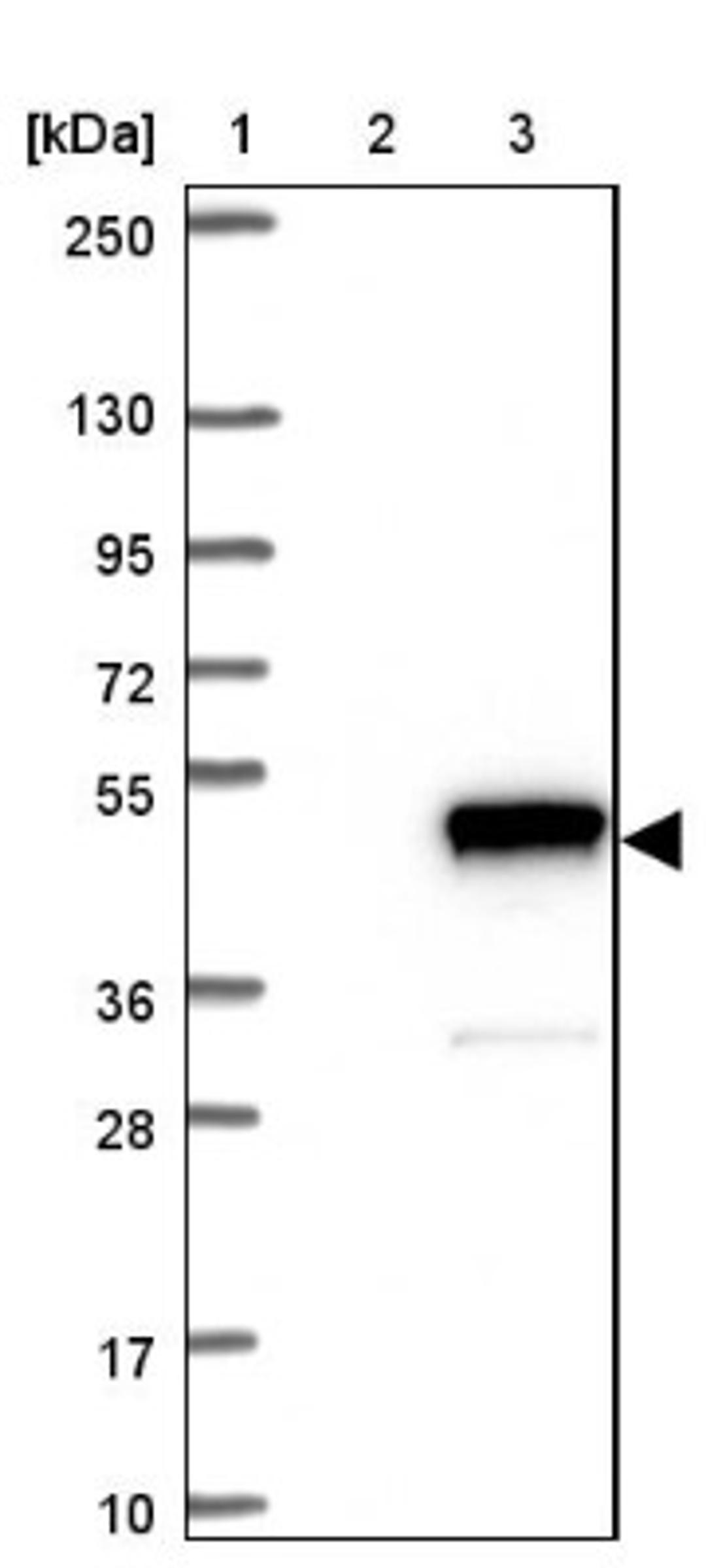 Western Blot: ADPRM Antibody [NBP1-81247] - Lane 1: Marker [kDa] 250, 130, 95, 72, 55, 36, 28, 17, 10<br/>Lane 2: Negative control (vector only transfected HEK293T lysate)<br/>Lane 3: Over-expression lysate (Co-expressed with a C-terminal myc-DDK tag (~3.1 kDa) in mammalian HEK293T cells, LY412569)