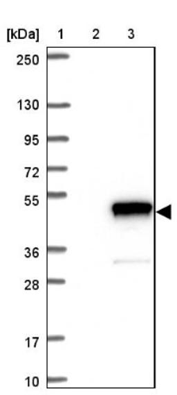 Western Blot: ADPRM Antibody [NBP1-81247] - Lane 1: Marker [kDa] 250, 130, 95, 72, 55, 36, 28, 17, 10<br/>Lane 2: Negative control (vector only transfected HEK293T lysate)<br/>Lane 3: Over-expression lysate (Co-expressed with a C-terminal myc-DDK tag (~3.1 kDa) in mammalian HEK293T cells, LY412569)