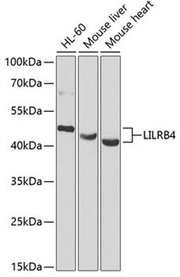 Western blot - LILRB4 antibody (A7073)