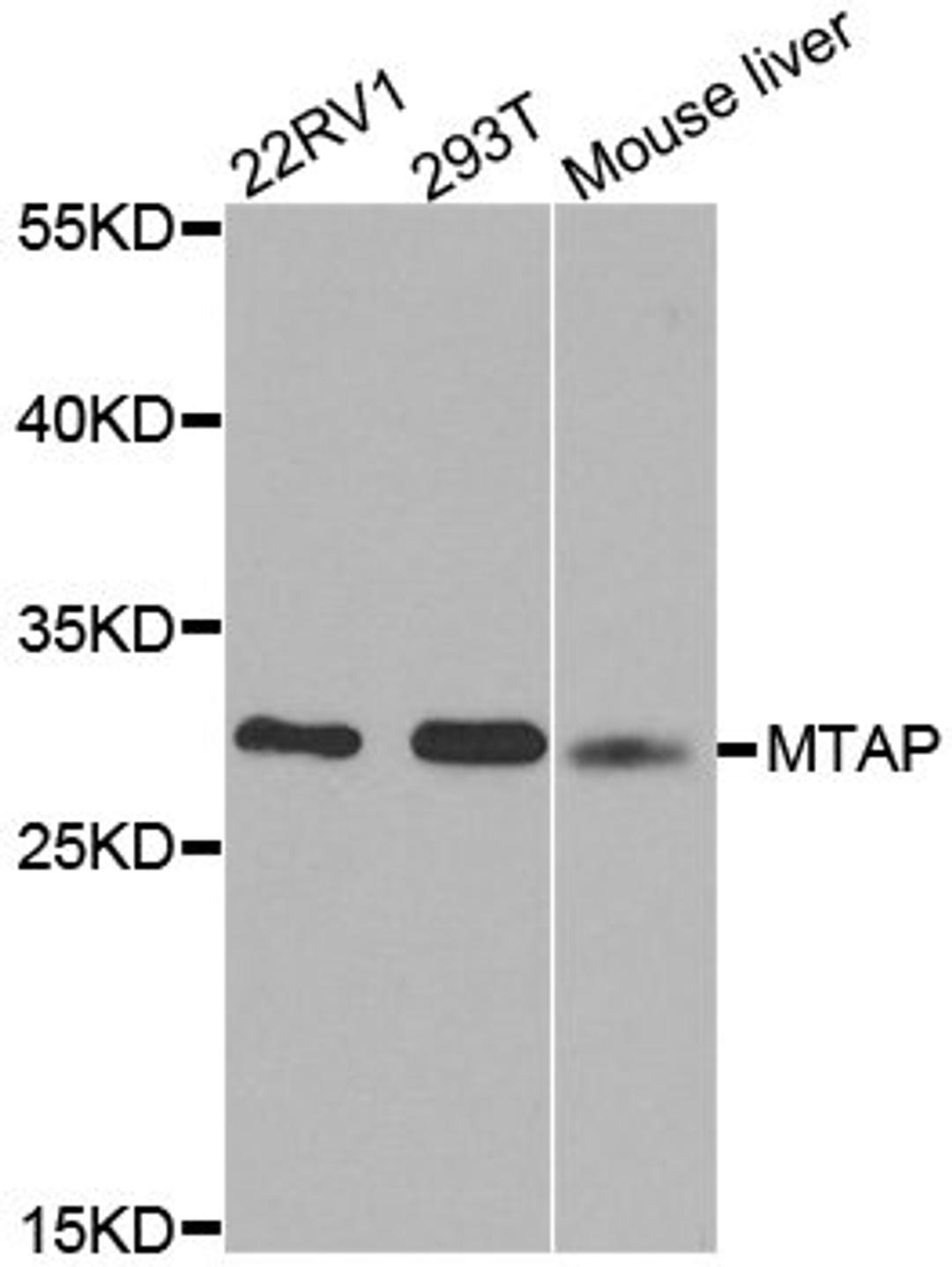 Western blot - MTAP antibody (A1049)