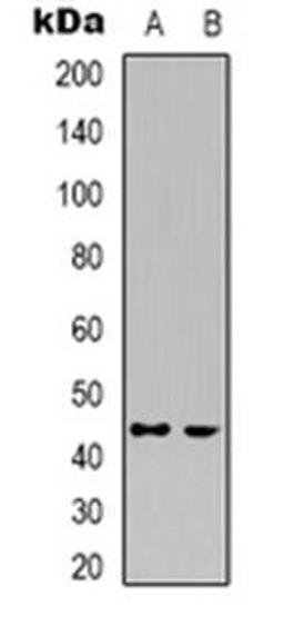 Western blot analysis of CDK15 expression in HepG2 (Lane 1), Jurkat (Lane 2) whole cell lysates using CDK15 antibody