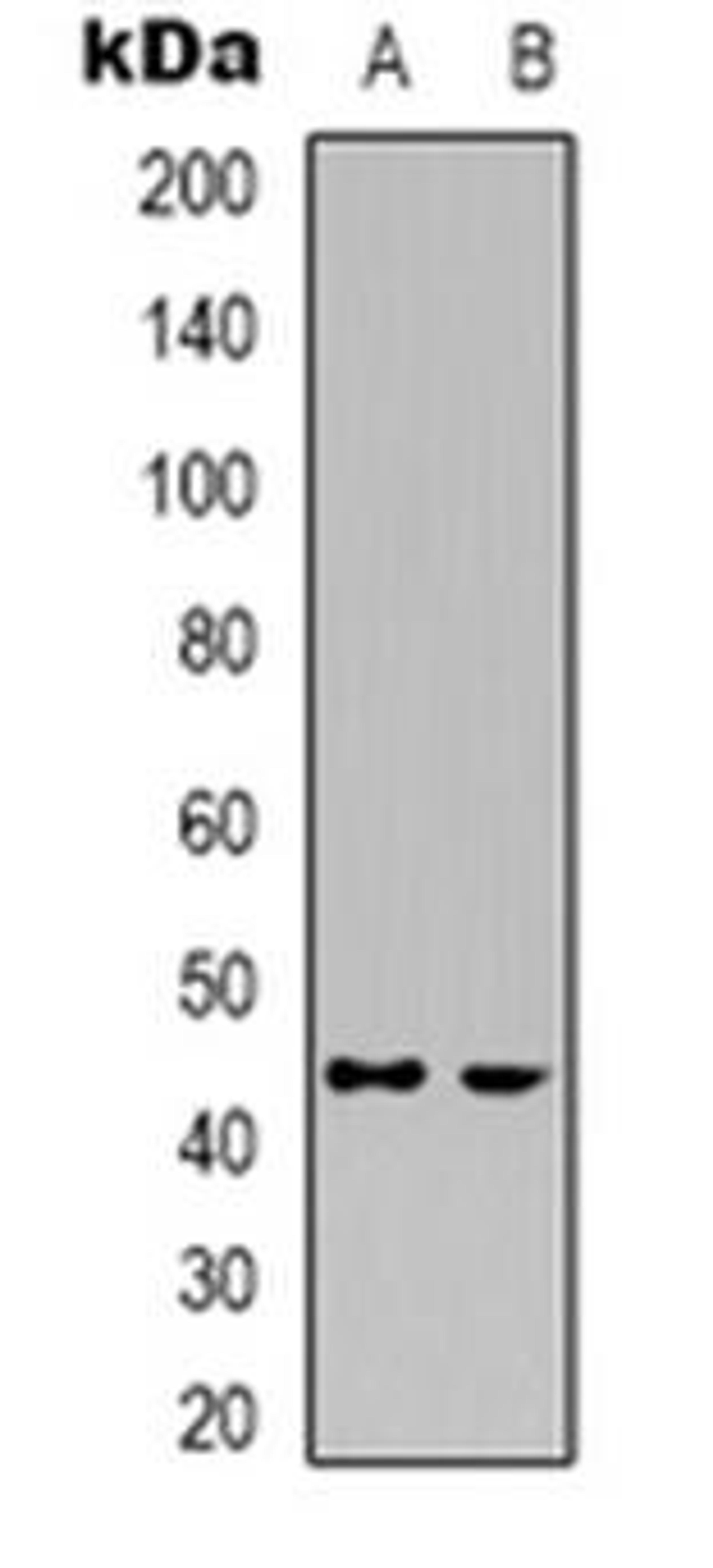 Western blot analysis of CDK15 expression in HepG2 (Lane 1), Jurkat (Lane 2) whole cell lysates using CDK15 antibody