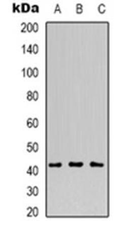 Western blot analysis of MVK expression in Raji (Lane 1), HepG2 (Lane 2), COS7 (Lane 3) whole cell lysates using MVK antibody