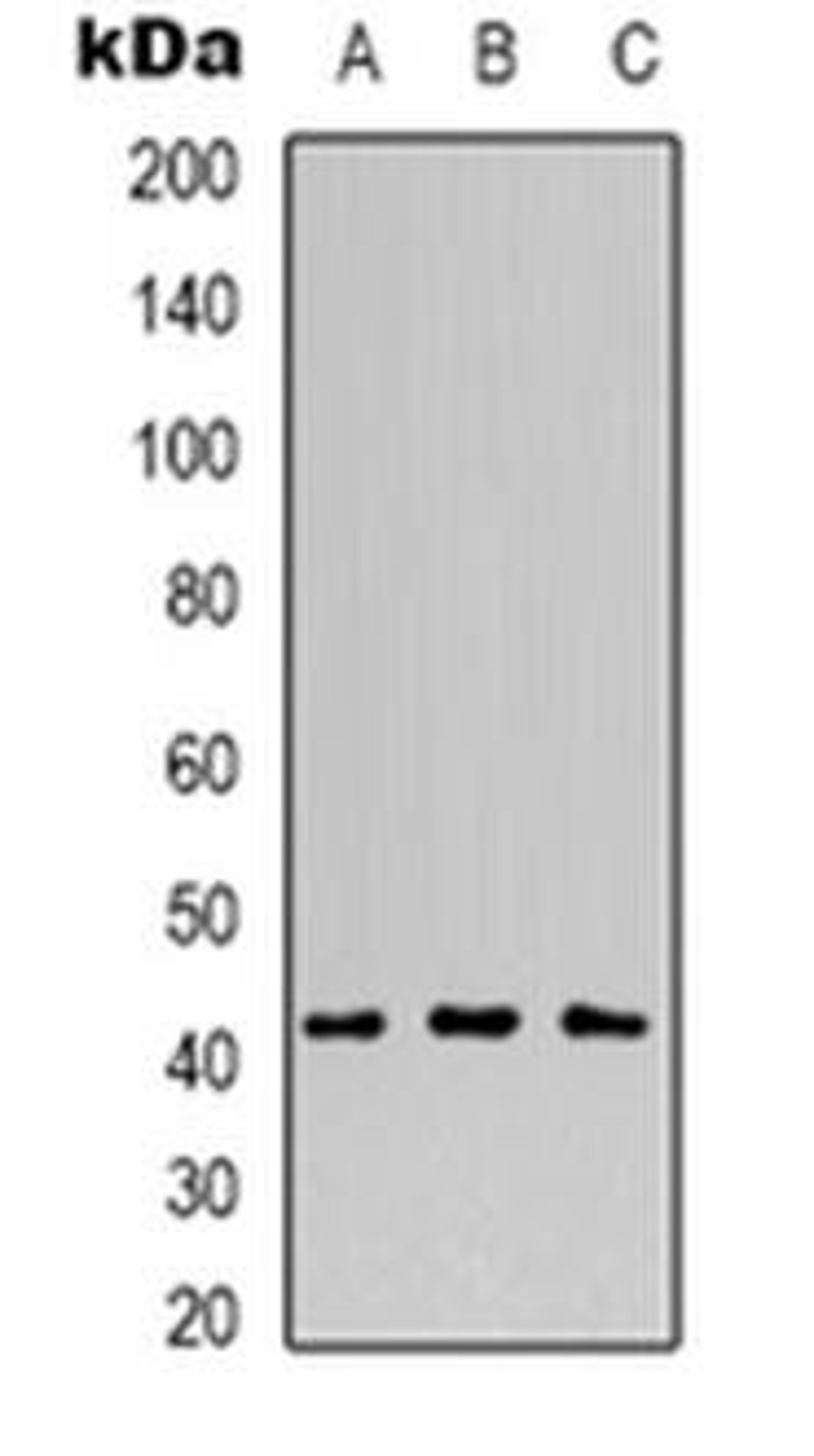 Western blot analysis of MVK expression in Raji (Lane 1), HepG2 (Lane 2), COS7 (Lane 3) whole cell lysates using MVK antibody