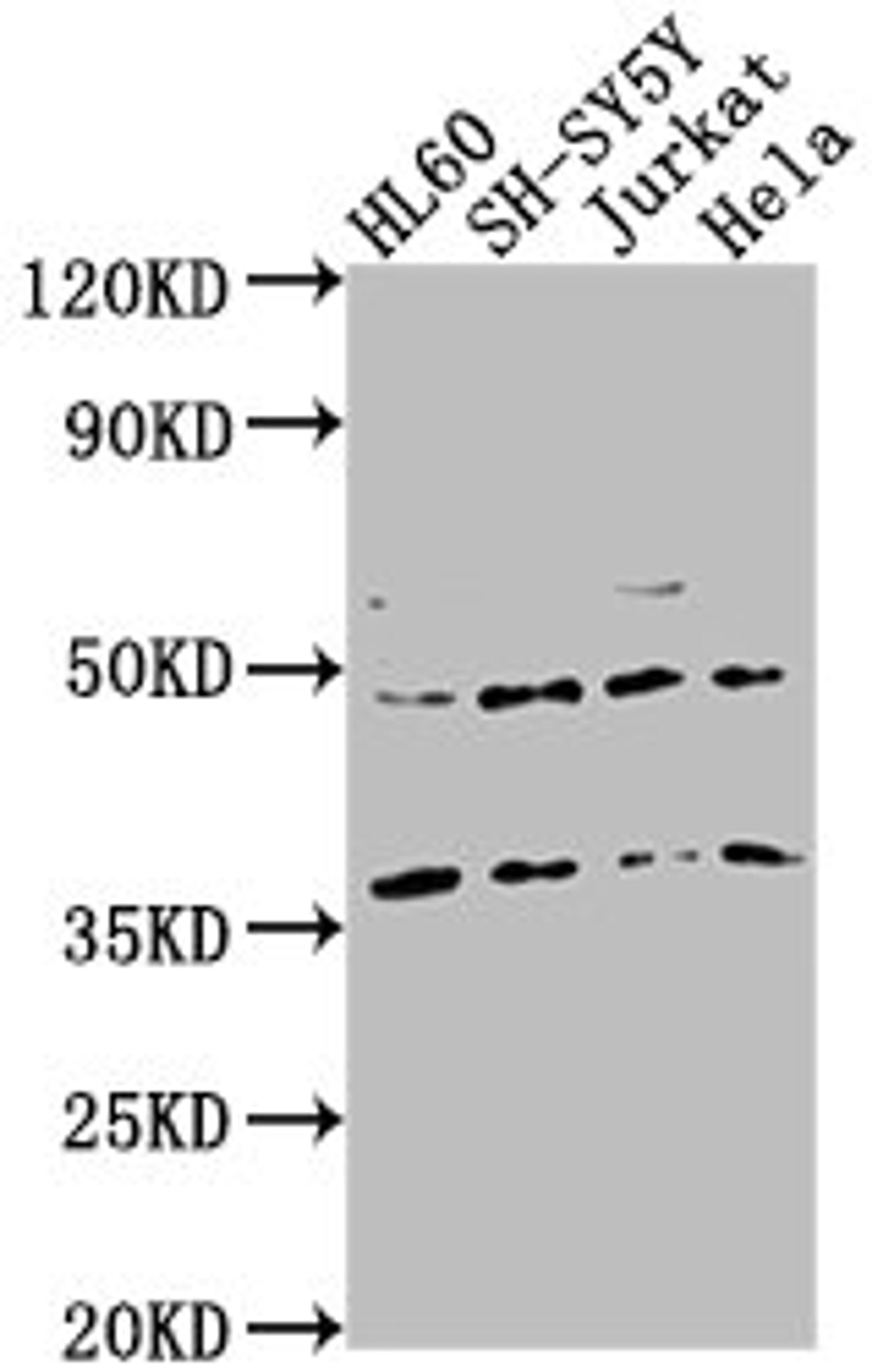 Western Blot. Positive WB detected in: HL60 whole cell lysate, SH-SY5Y whole cell lysate, Jurkat whole cell lysate, Hela whole cell lysate. All lanes: CASTOR2 antibody at 1:2000. Secondary. Goat polyclonal to rabbit IgG at 1/50000 dilution. Predicted band size: 37 kDa. Observed band size: 37 kDa. 