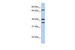 Antibody used in WB on Human HeLa at 0.2-1 ug/ml.