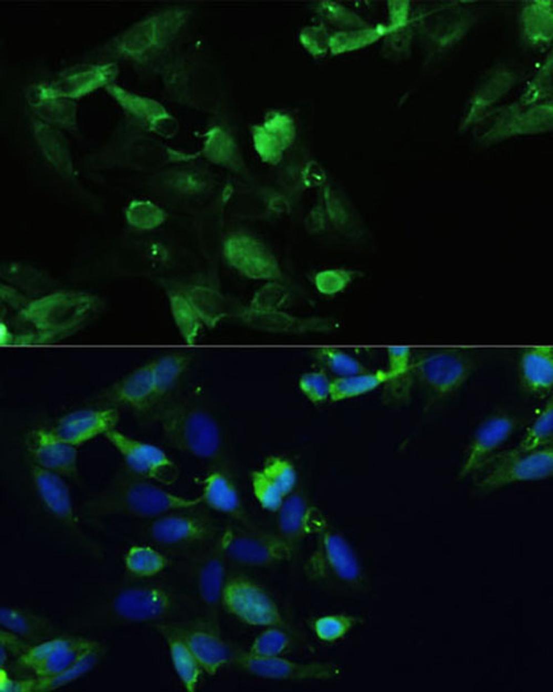 Immunofluorescence - CXCR5 antibody (A14233)