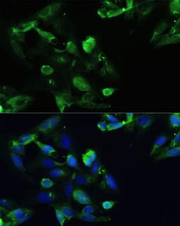 Immunofluorescence - CXCR5 antibody (A14233)