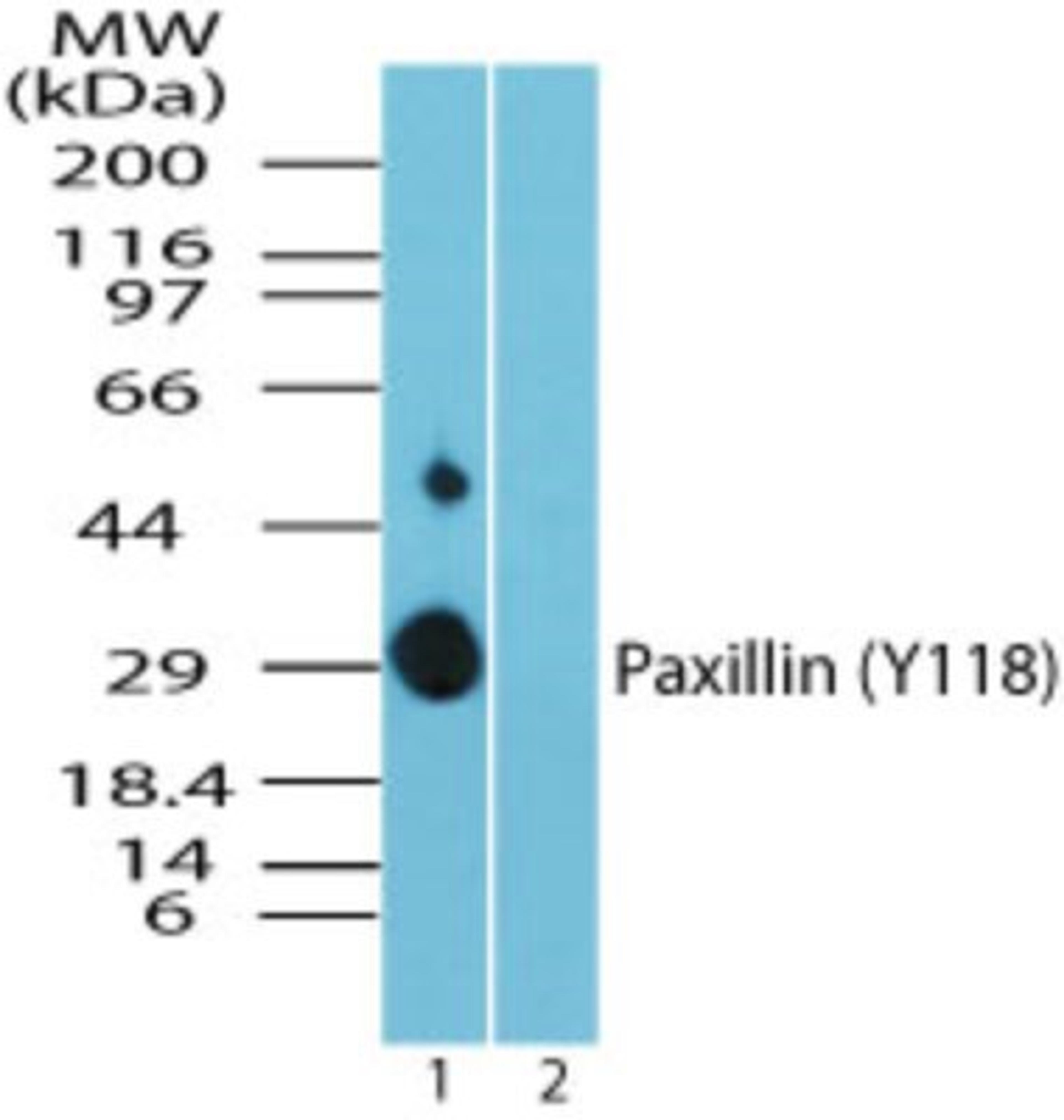 Western Blot: Paxillin [p Tyr118] Antibody [NBP2-24459] - Analysis of phospho Paxillin (Y118) in recombinant fusion protein containing 1) a phosphorylated tyrosine at position 118 and 2) an unphosphorylated tyrosine at position 118, using paxillin phospho antibody at 0.025 ug/ml. Goat anti-rabbit Ig HRP secondary antibody and PicoTect ECL substrate solution were used for this test.