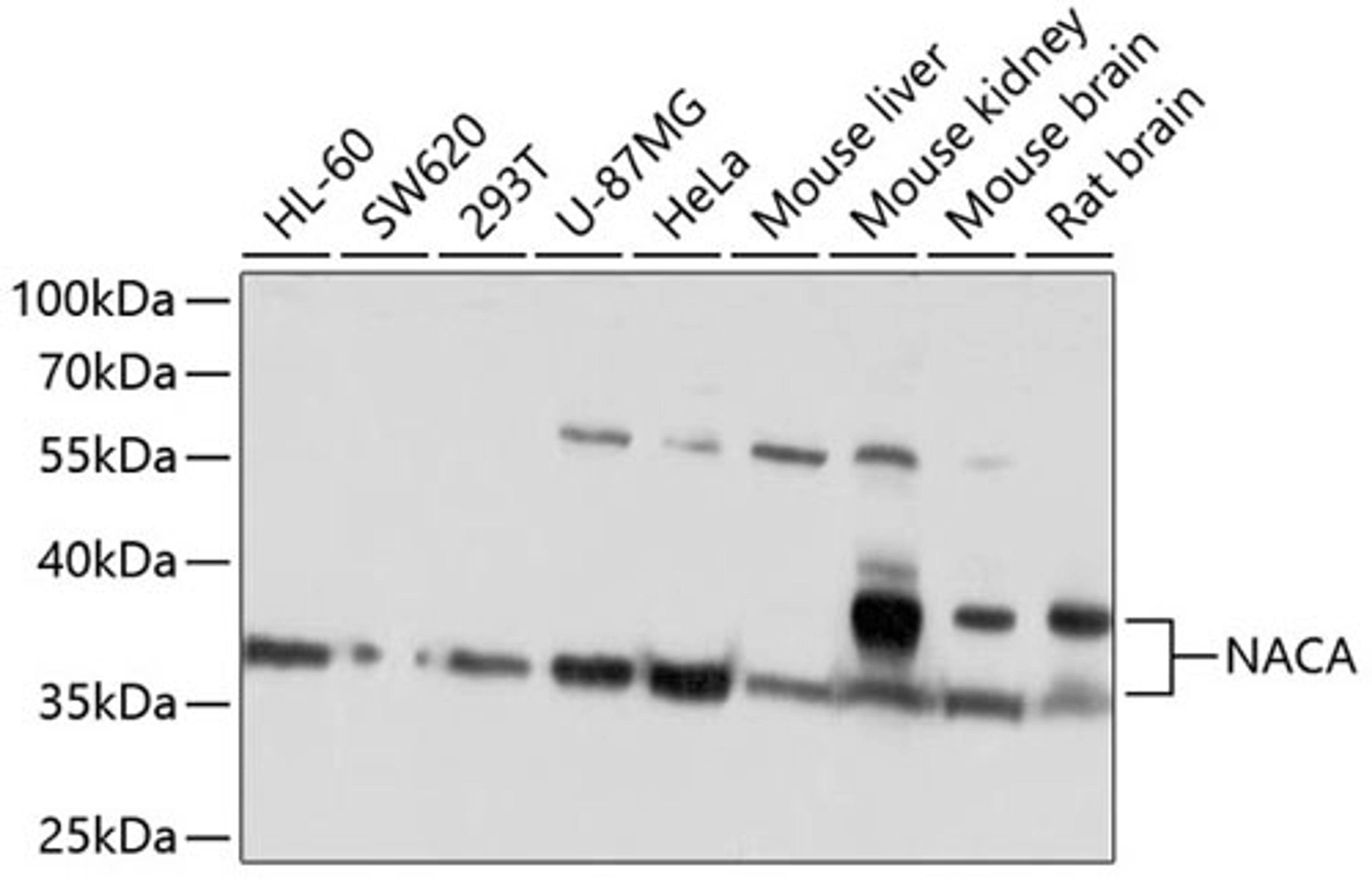 Western blot - NACA antibody (A10122)