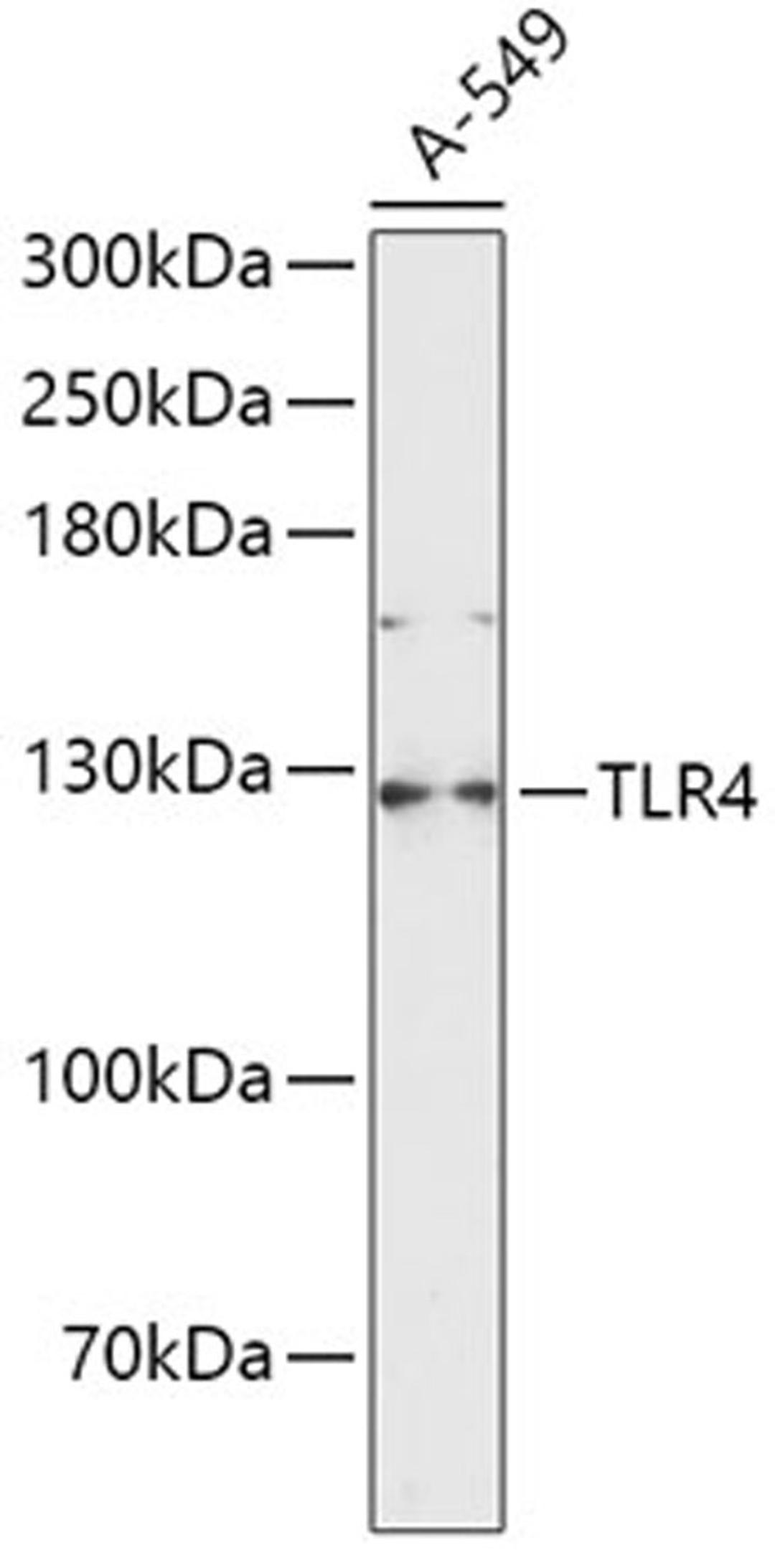 Western blot - TLR4 antibody (A5258)