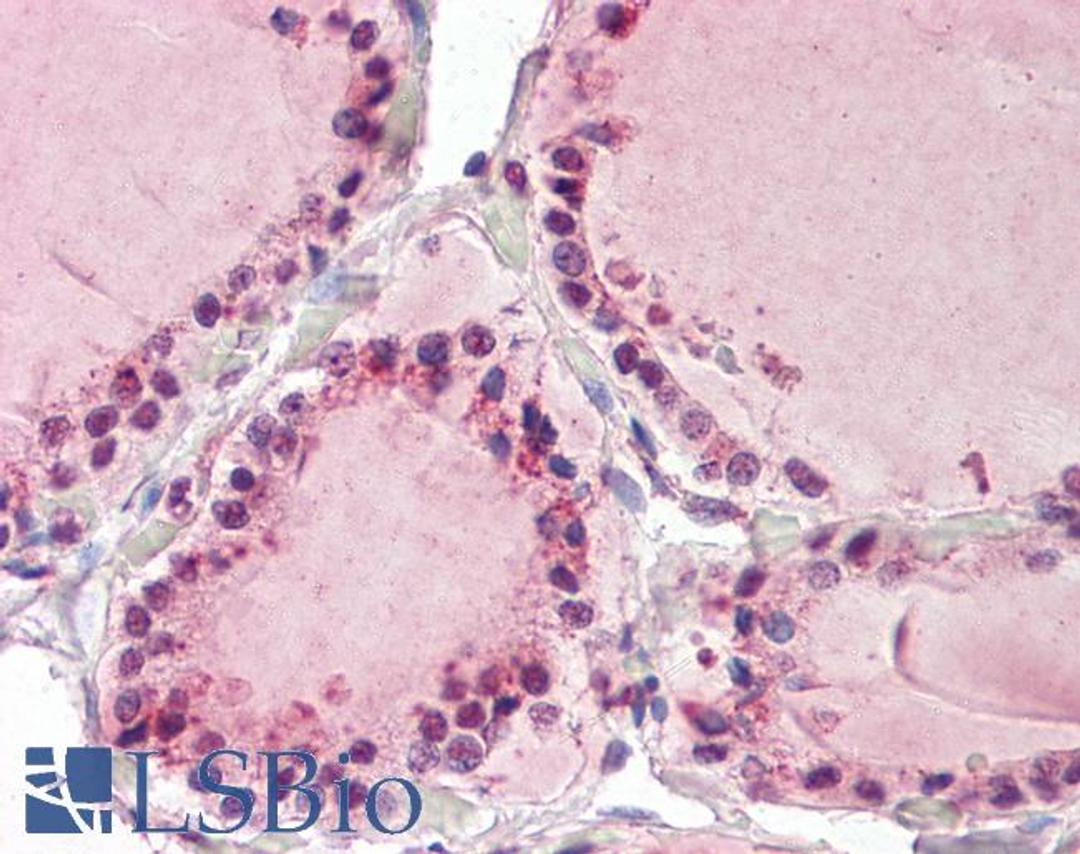 45-864 (3.75ug/ml) staining of paraffin embedded Human Thyroid. Steamed antigen retrieval with citrate buffer pH 6, AP-staining.