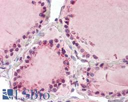 45-864 (3.75ug/ml) staining of paraffin embedded Human Thyroid. Steamed antigen retrieval with citrate buffer pH 6, AP-staining.