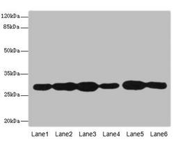 Western blot. All lanes: PMM2 antibody at 3.8µg/ml. Lane 1: A549 whole cell lysate. Lane 2: HepG2 whole cell lysate. Lane 3: MCF-7 whole cell lysate. Lane 4: K562 whole cell lysate. Lane 5: Hela whole cell lysate. Lane 6: 293T whole cell lysate. Secondary. Goat polyclonal to rabbit IgG at 1/10000 dilution. Predicted band size: 29, 14 kDa. Observed band size: 29 kDa