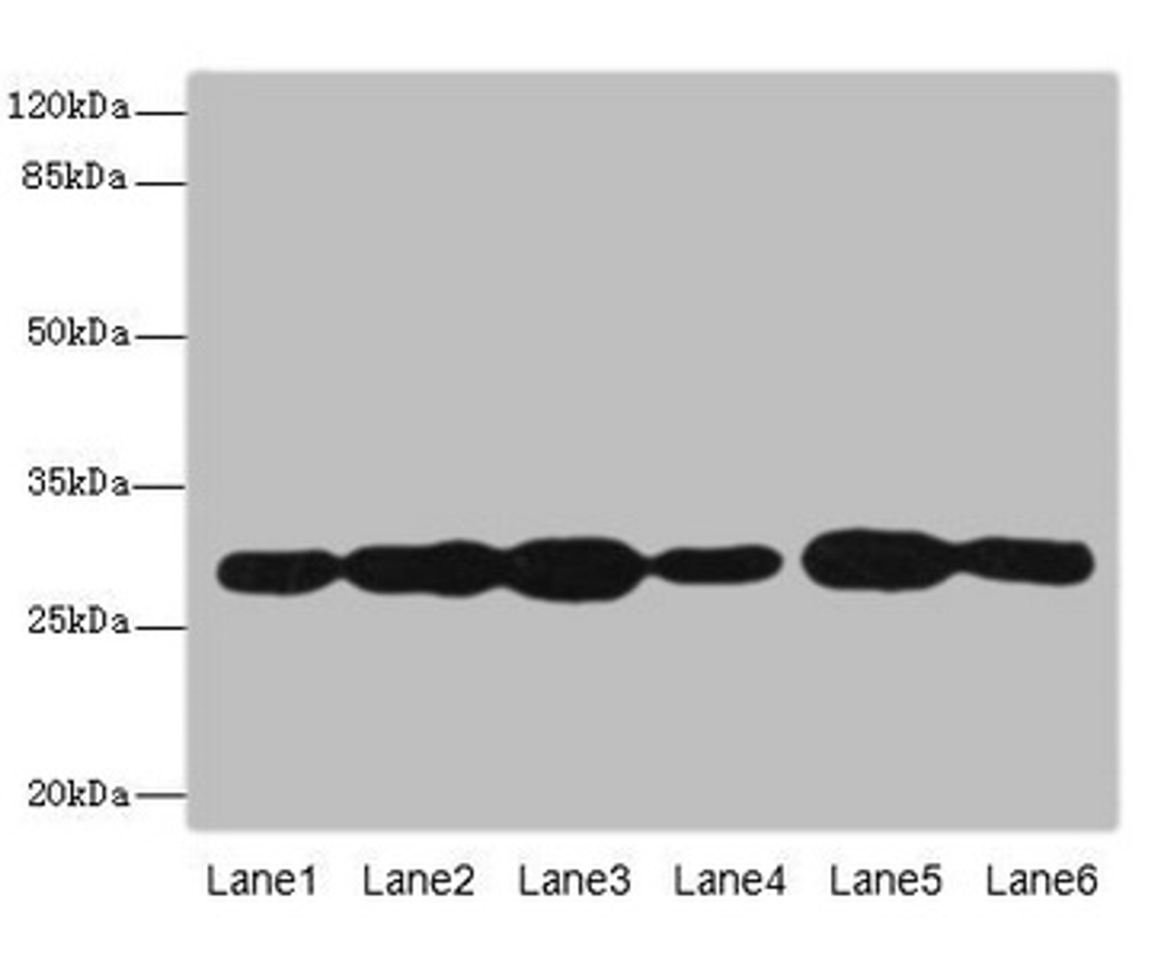 Western blot. All lanes: PMM2 antibody at 3.8µg/ml. Lane 1: A549 whole cell lysate. Lane 2: HepG2 whole cell lysate. Lane 3: MCF-7 whole cell lysate. Lane 4: K562 whole cell lysate. Lane 5: Hela whole cell lysate. Lane 6: 293T whole cell lysate. Secondary. Goat polyclonal to rabbit IgG at 1/10000 dilution. Predicted band size: 29, 14 kDa. Observed band size: 29 kDa