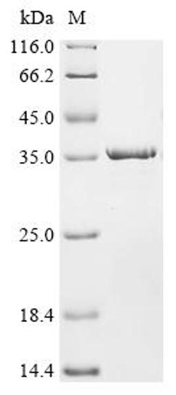 (Tris-Glycine gel) Discontinuous SDS-PAGE (reduced) with 5% enrichment gel and 15% separation gel.