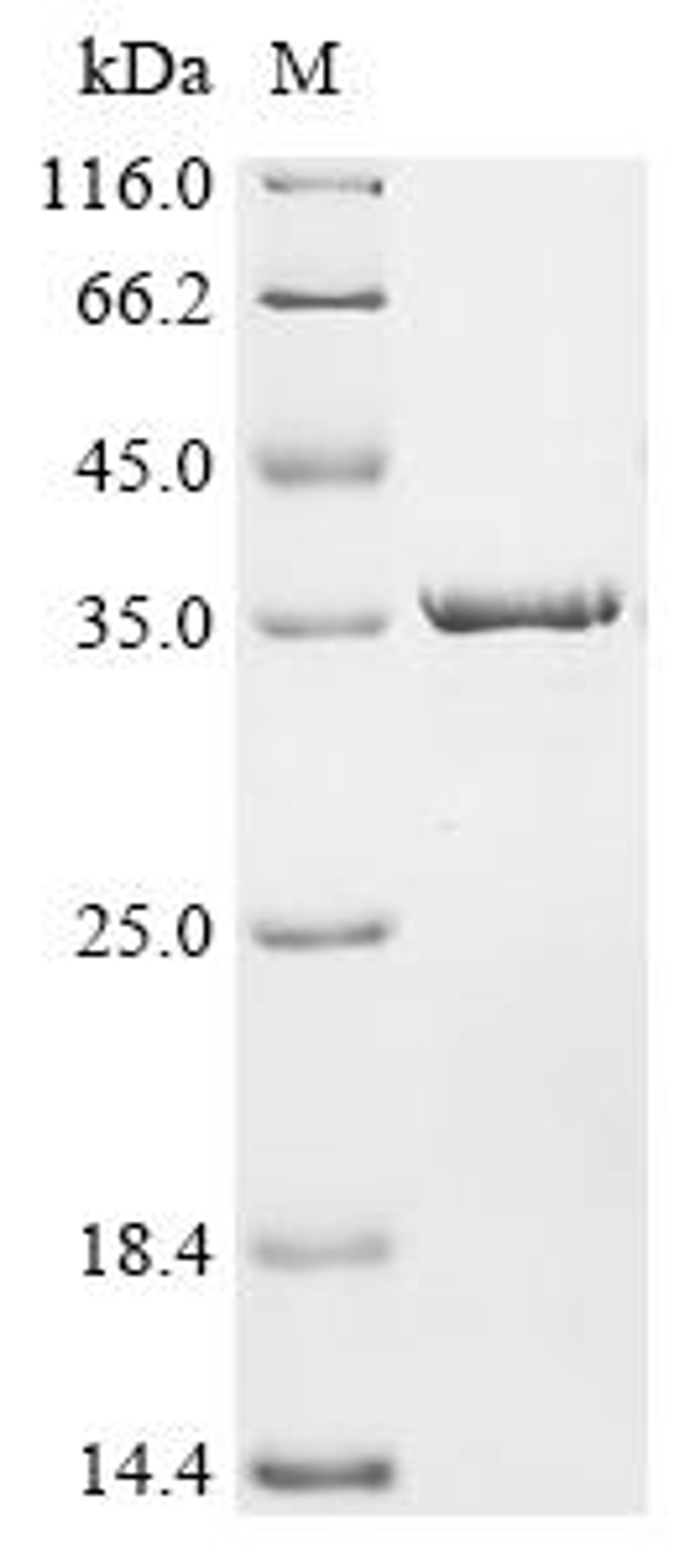 (Tris-Glycine gel) Discontinuous SDS-PAGE (reduced) with 5% enrichment gel and 15% separation gel.