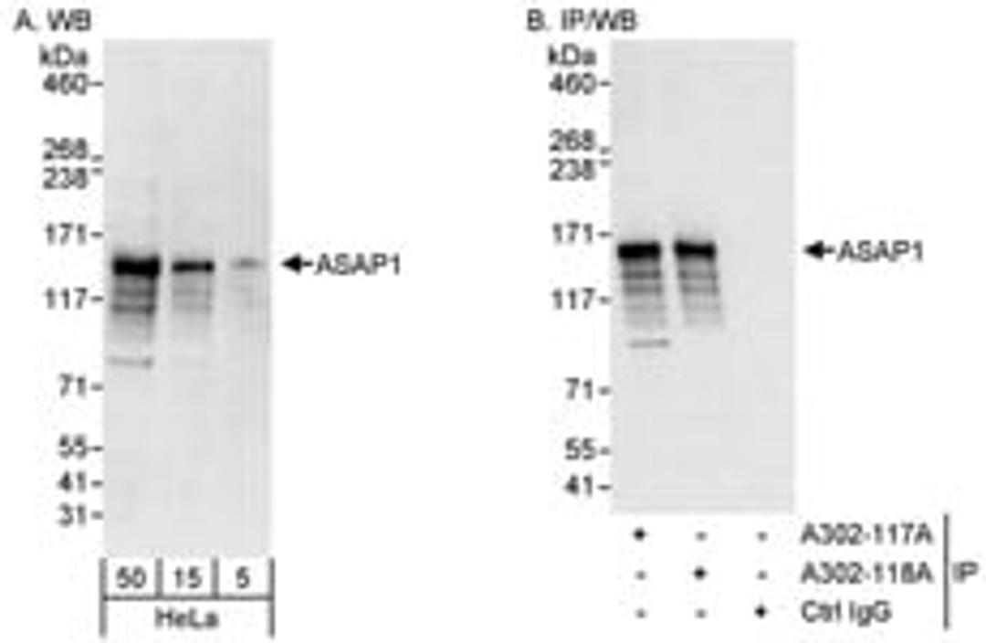 Detection of human ASAP1 by western blot and immunoprecipitation.