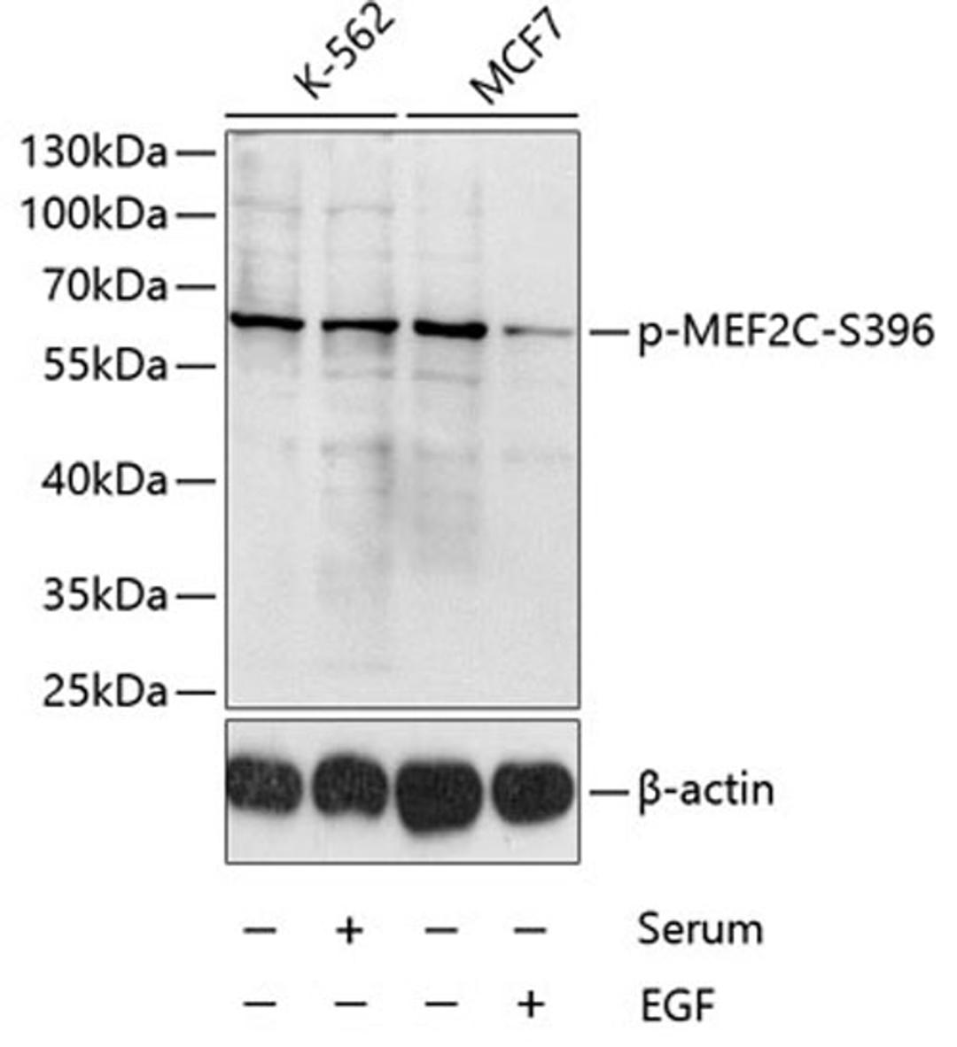 Western blot - Phospho-MEF2C-S396 antibody (AP0075)