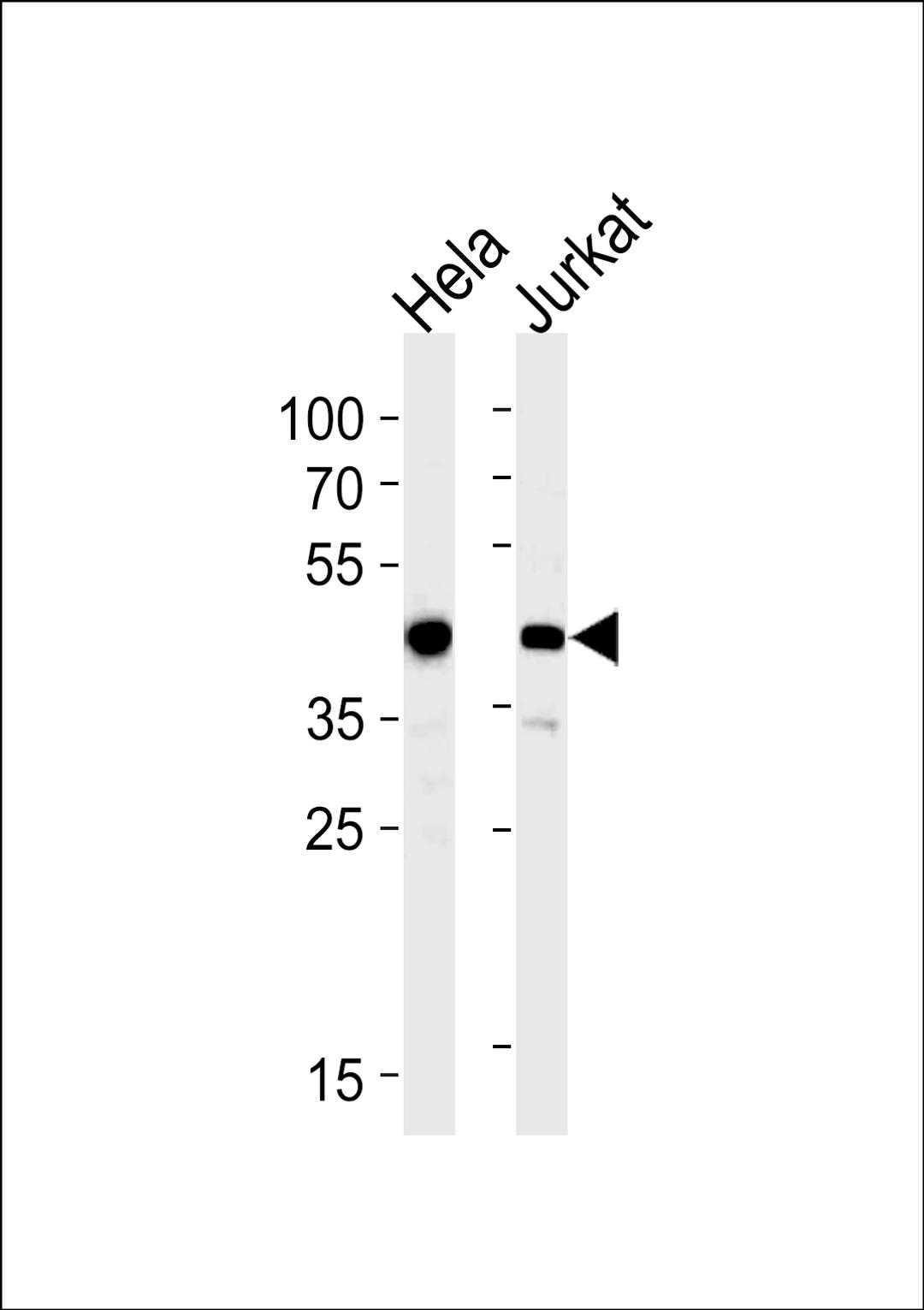 Western blot analysis in Hela,Jurkat cell line lysates (35ug/lane).