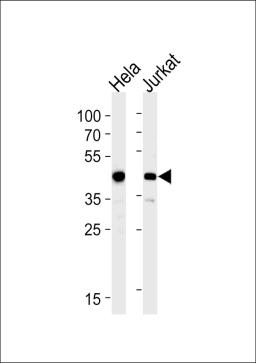 Western blot analysis in Hela,Jurkat cell line lysates (35ug/lane).