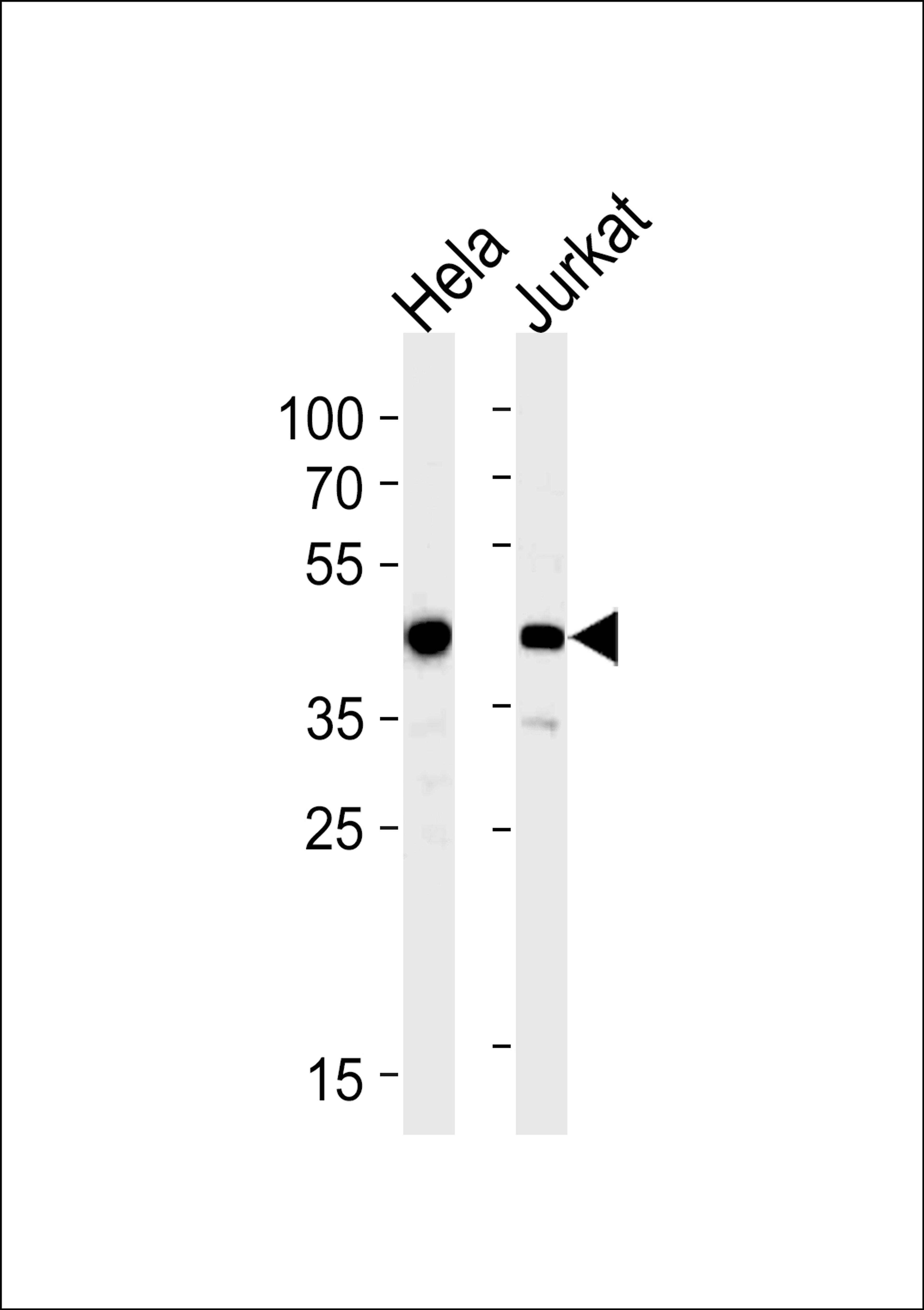 Western blot analysis in Hela,Jurkat cell line lysates (35ug/lane).