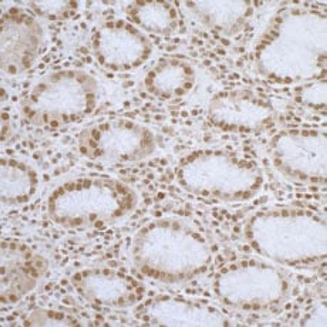 Detection of human ELAC2 by immunohistochemistry.