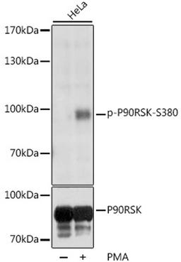 Western blot - Phospho-P90RSK-S380 antibody (AP0562)