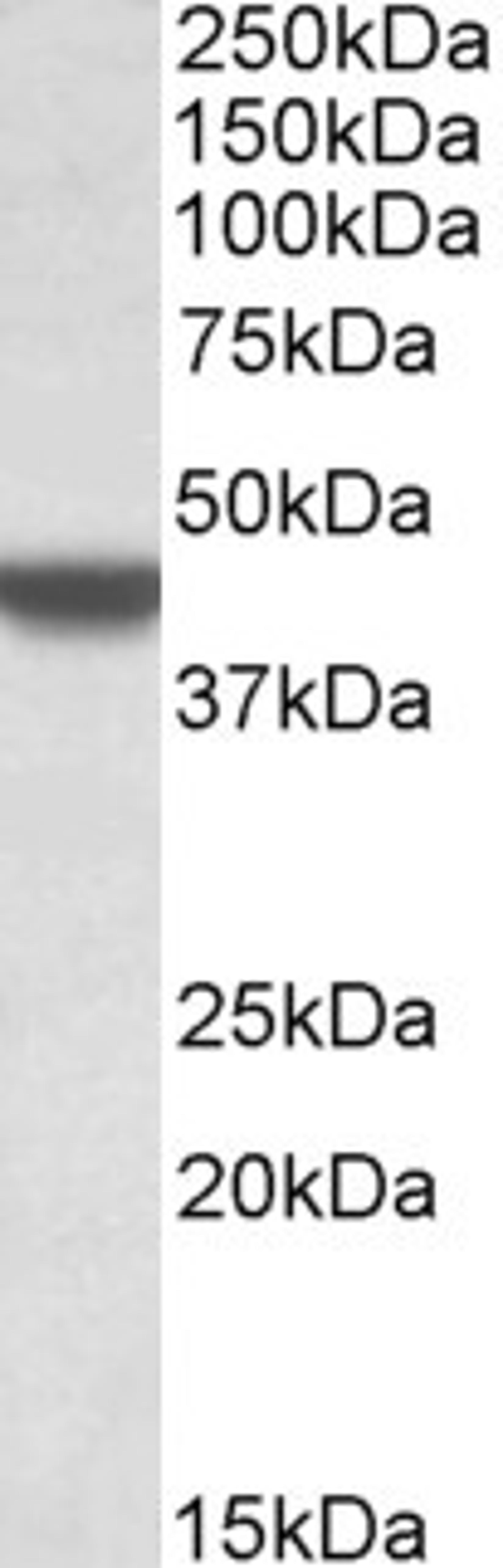 42-853 (0.3ug/ml) staining of A549 lysate (35ug protein in RIPA buffer). Primary incubation was 1 hour. Detected by chemiluminescence.