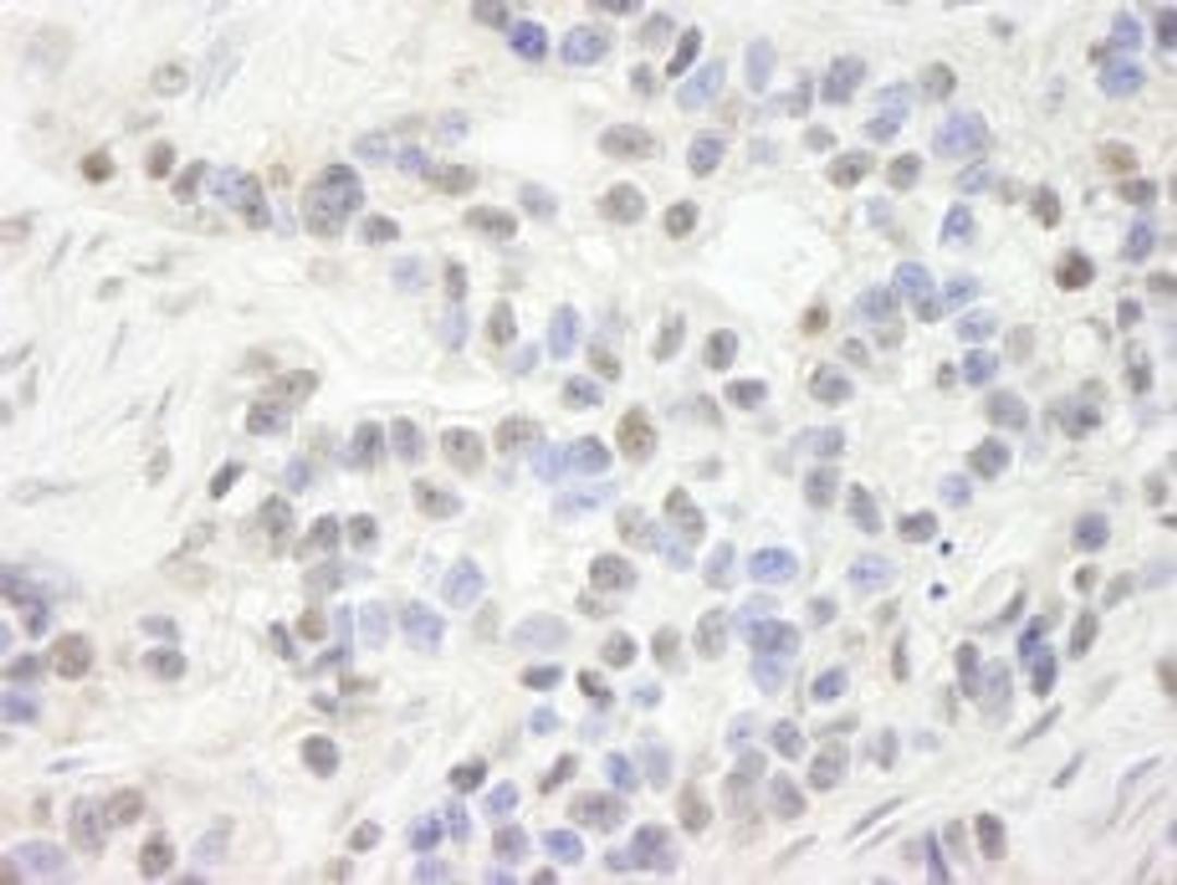 Detection of human NP95/UHRF1 by immunohistochemistry.