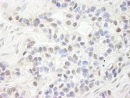 Detection of human NP95/UHRF1 by immunohistochemistry.