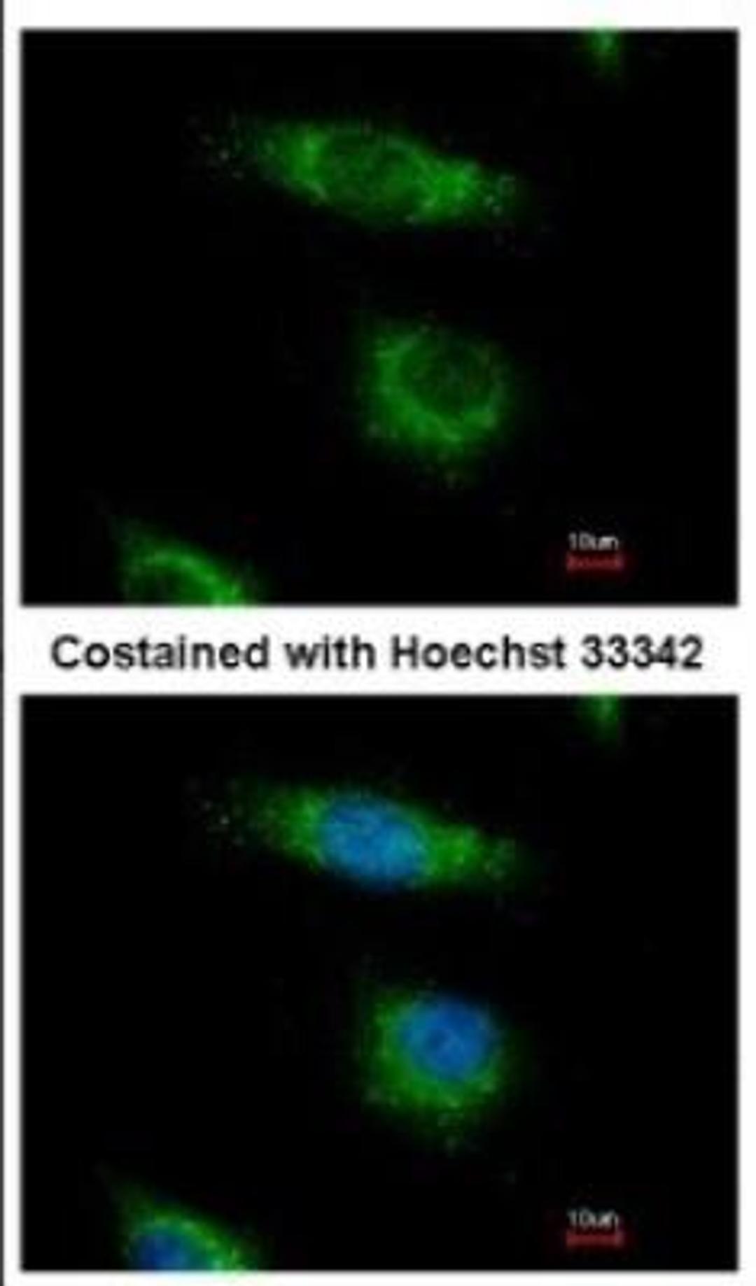 Immunocytochemistry/Immunofluorescence: OSBPL5 Antibody [NBP2-19638] - Immunofluorescence analysis of paraformaldehyde-fixed HeLa, using antibody at 1:500 dilution.