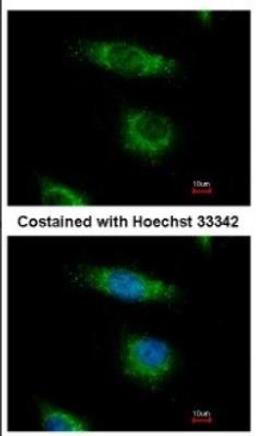 Immunocytochemistry/Immunofluorescence: OSBPL5 Antibody [NBP2-19638] - Immunofluorescence analysis of paraformaldehyde-fixed HeLa, using antibody at 1:500 dilution.