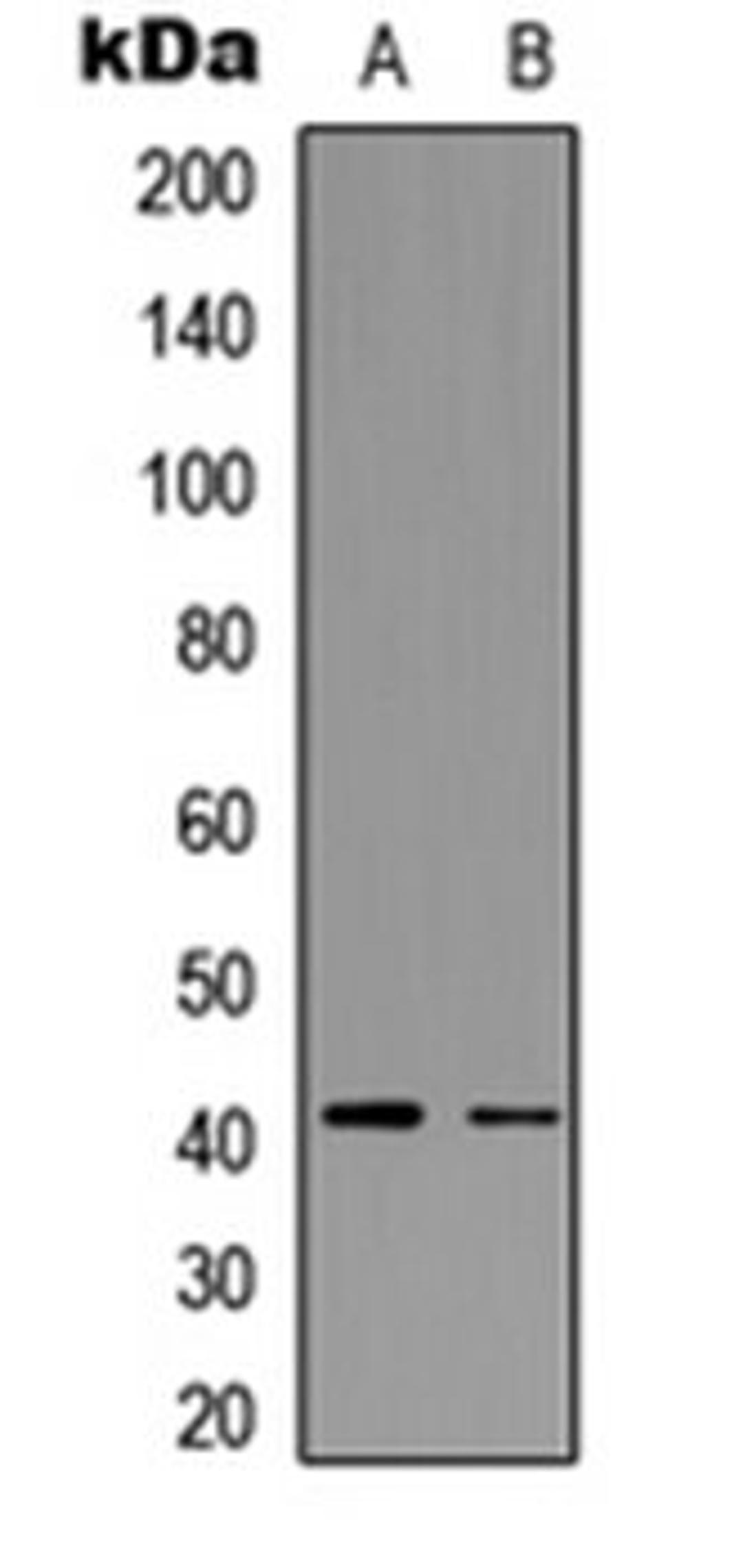 Western blot analysis of Jurkat (Lane 1), mouse mammary tumor (Lane 2) whole cell lysates using CCR5 (phospho-S336) antibody