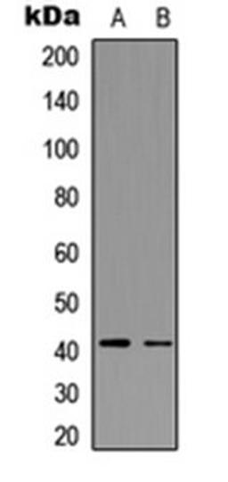 Western blot analysis of Jurkat (Lane 1), mouse mammary tumor (Lane 2) whole cell lysates using CCR5 (phospho-S336) antibody