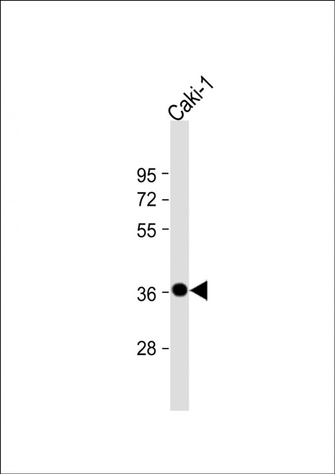 Western Blot at 1:2000 dilution + Caki-1 whole cell lysate Lysates/proteins at 20 ug per lane.