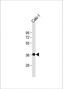 Western Blot at 1:2000 dilution + Caki-1 whole cell lysate Lysates/proteins at 20 ug per lane.