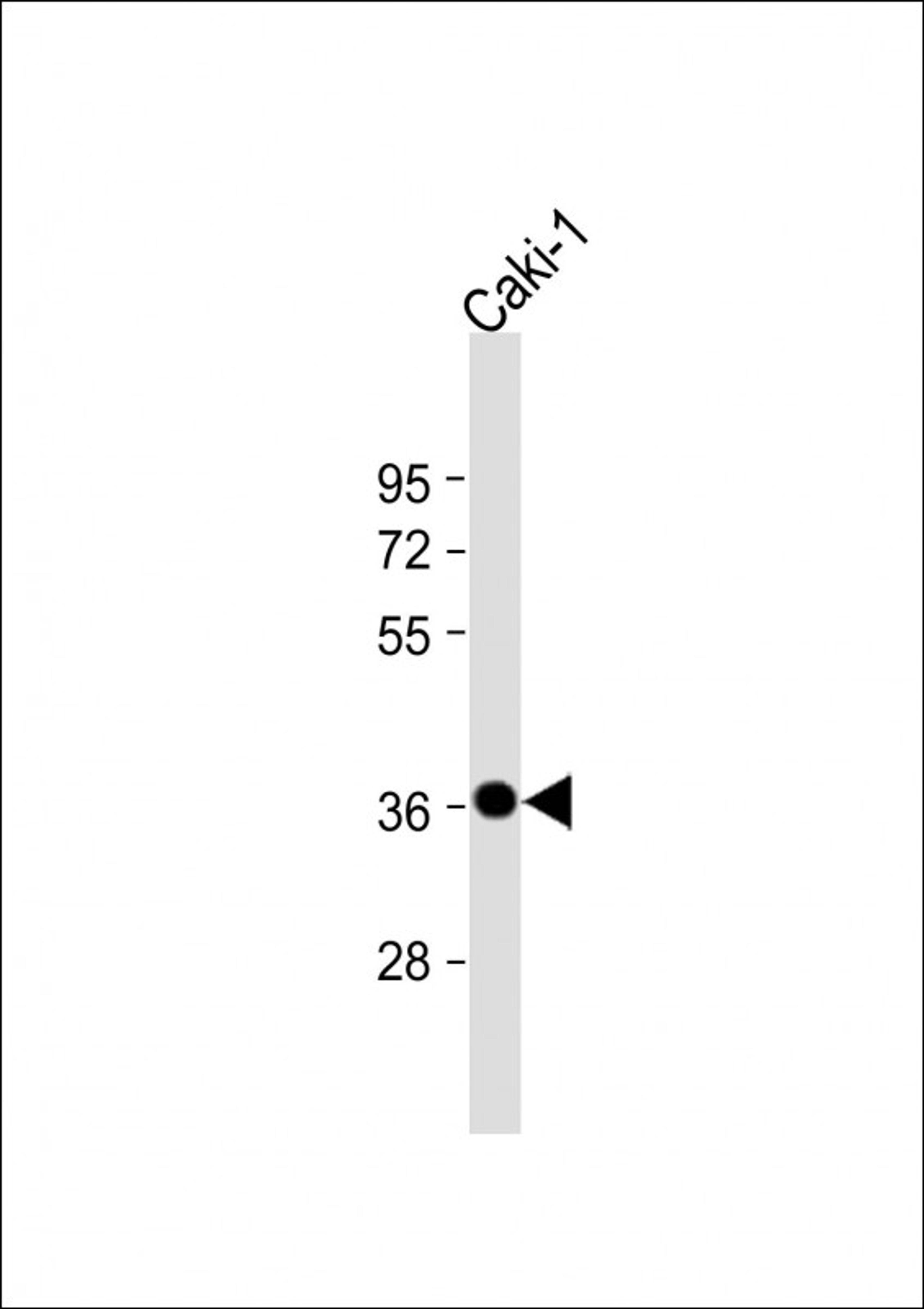 Western Blot at 1:2000 dilution + Caki-1 whole cell lysate Lysates/proteins at 20 ug per lane.