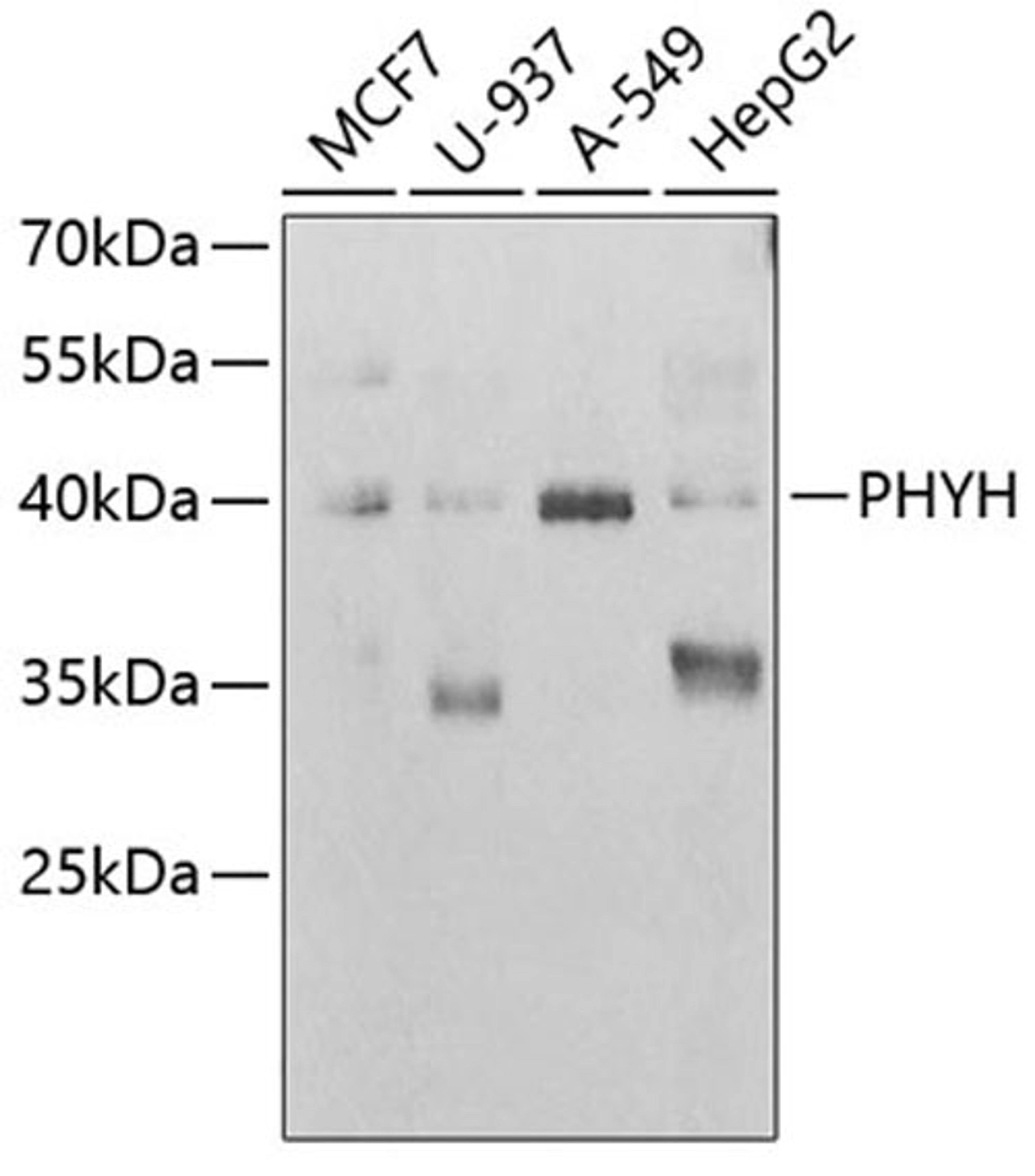 Western blot - PHYH antibody (A6304)