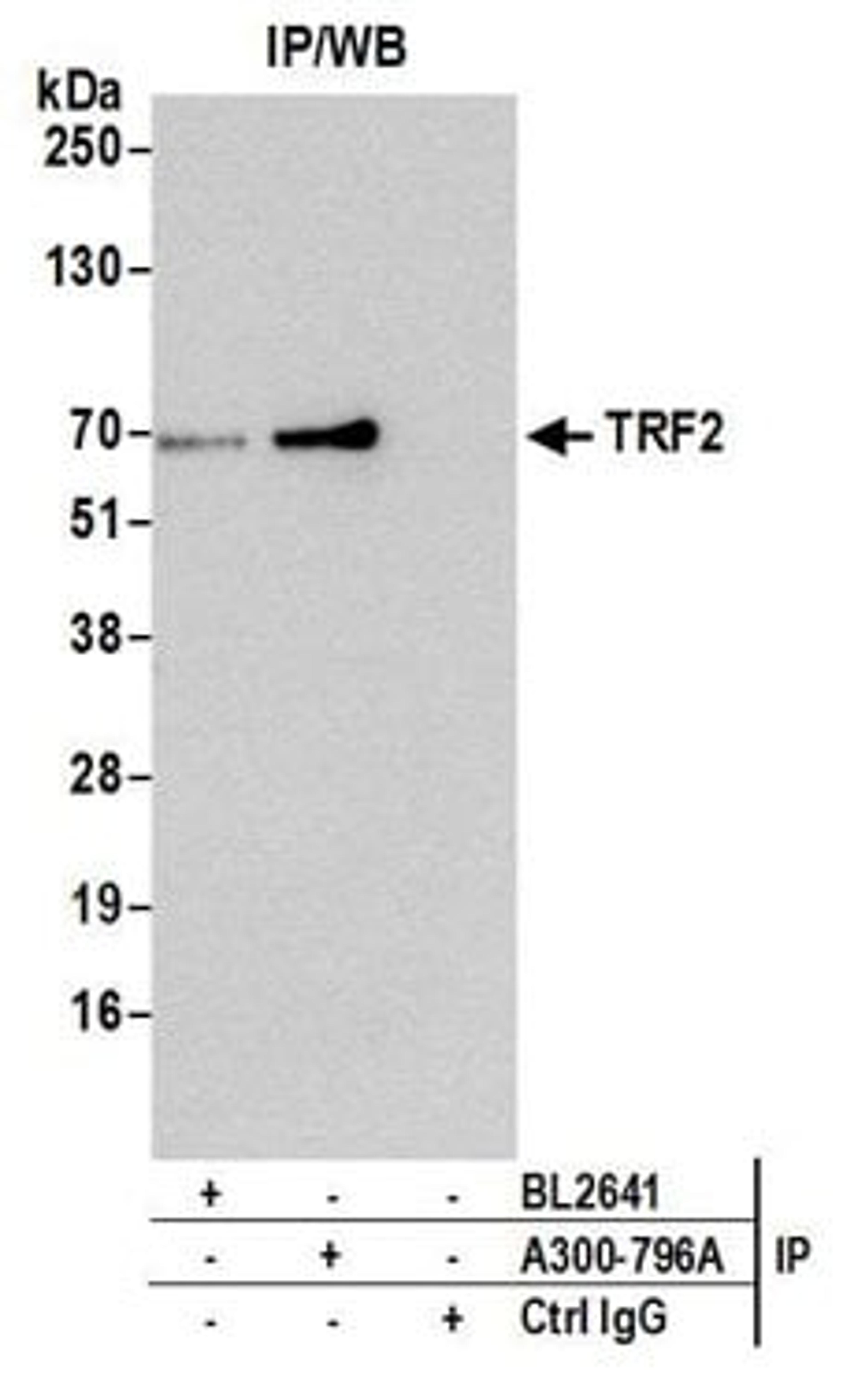 Detection of human TRF2 by western blot of immunoprecipitates.