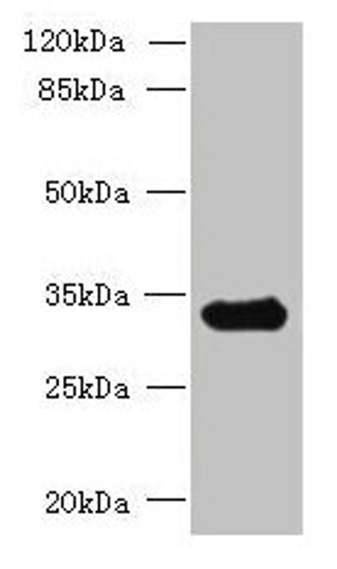 Western blot. All lanes: CCDC106 antibody at 4µg/ml + Mouse brain tissue. Secondary. Goat polyclonal to rabbit IgG at 1/10000 dilution. Predicted band size: 33 kDa. Observed band size: 33 kDa