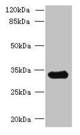 Western blot. All lanes: CCDC106 antibody at 4µg/ml + Mouse brain tissue. Secondary. Goat polyclonal to rabbit IgG at 1/10000 dilution. Predicted band size: 33 kDa. Observed band size: 33 kDa
