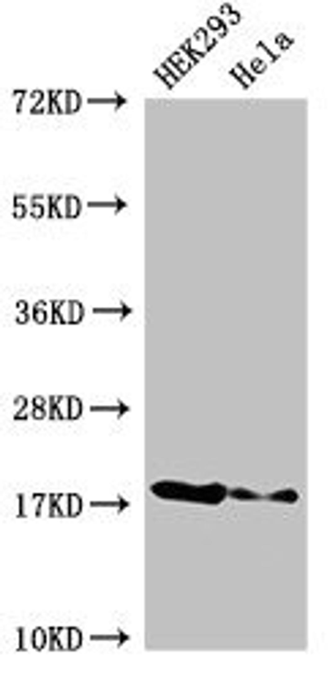 Western Blot. Positive WB detected in: HEK293 whole cell lysate, Hela whole cell lysate. All lanes: RNASEH2C antibody at 3ug/ml. Secondary. Goat polyclonal to rabbit IgG at 1/50000 dilution. Predicted band size: 18 kDa. Observed band size: 18 kDa. 