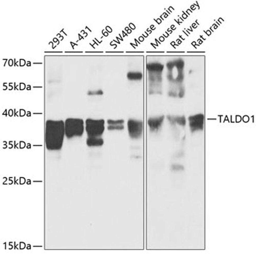 Western blot - TALDO1 antibody (A13551)